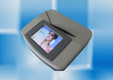 machine de retrait de veine de l'araignée 30MHZ pour le visage, écran de 150W 8.4Inch
